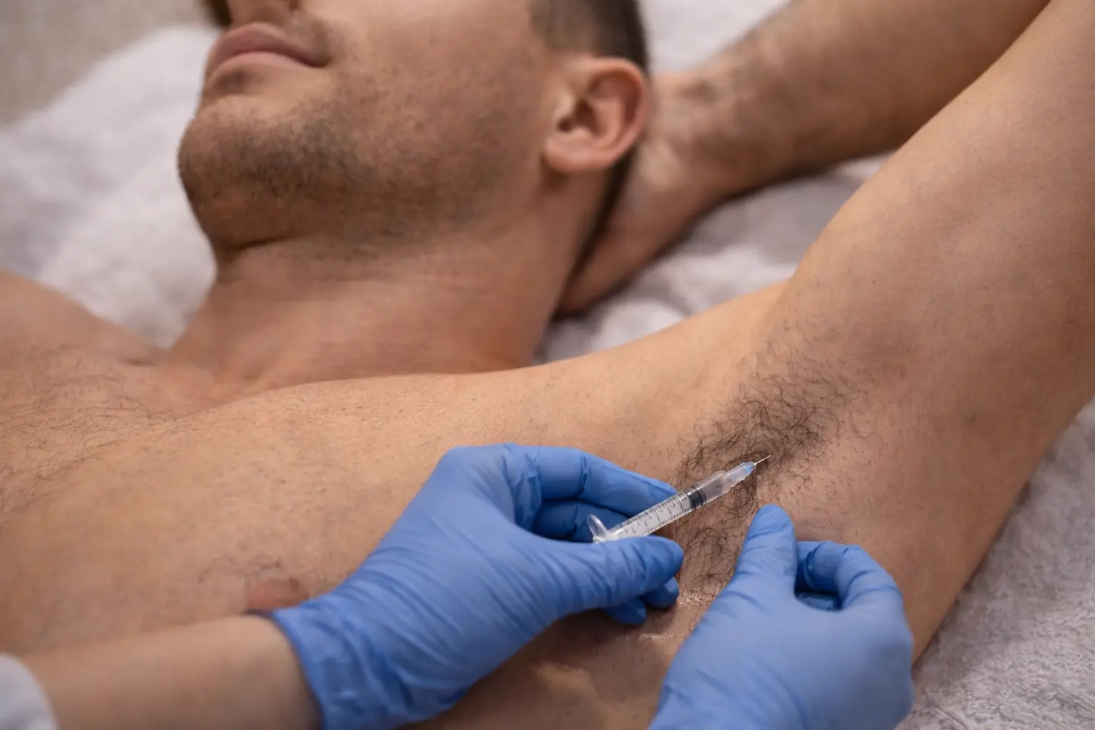 Лікування гіпергідрозу у SM.CLINIC